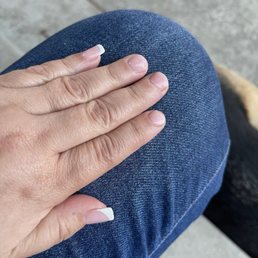Nails broken Nails broken