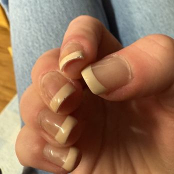 Leeven Nails - Nails chipping and yellow color. - Nail Technicians Near Me - Anderson, Indiana Leeven Nails - Nails chipping and yellow color. - Nail Technicians Near Me - Anderson, Indiana