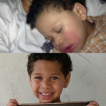 Nissi-Rapha - my son had very bad eczema from early on. 2013 vs 2016 it didn't even take this long for him to get better. But he's still doing good! - Nutritionists Near Me - Montebello, California Nissi-Rapha - my son had very bad eczema from early on. 2013 vs 2016 it didn't even take this long for him to get better. But he's still doing good! - Nutritionists Near Me - Montebello, California