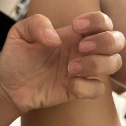How they left my nails after a removal