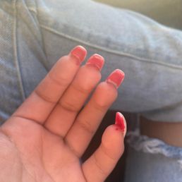 Eww bottom of nails