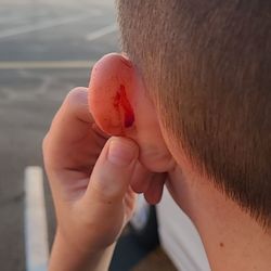 Cost Cutters - My bleeding ear