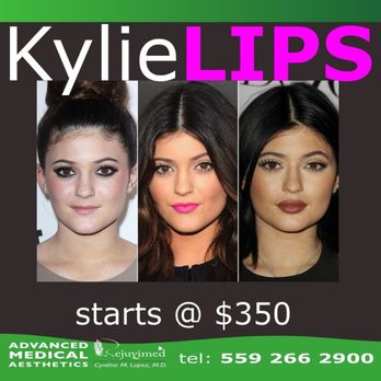 Rejuvimed - YOU deserve to have pretty, sculpted lips. Dr Lopez creates the most beautifully, natural looking lips. No duck lips No fish lips. - Medical Spas Near Me - Fresno, California Rejuvimed - YOU deserve to have pretty, sculpted lips. Dr Lopez creates the most beautifully, natural looking lips. No duck lips No fish lips. - Medical Spas Near Me - Fresno, California