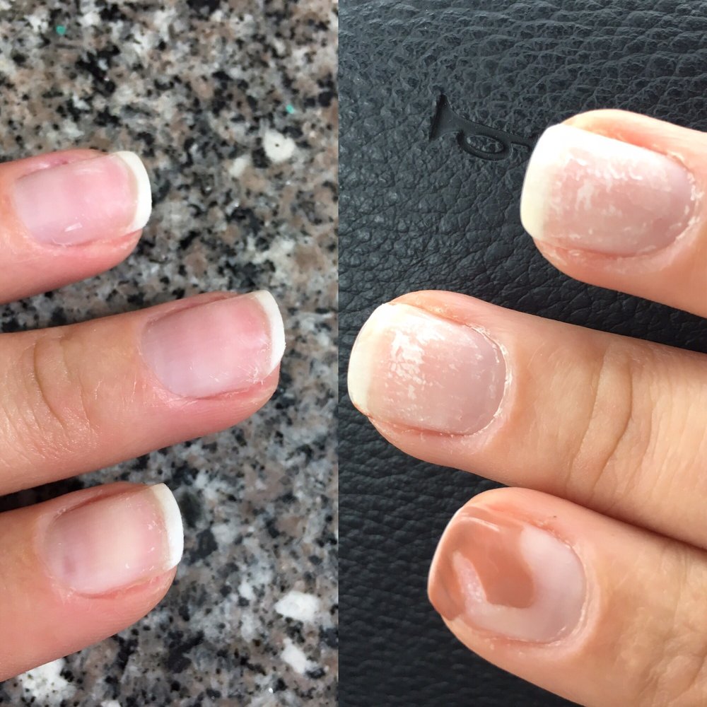 Proper polish removal on the left improper polish removal on the right from this salon! Proper polish removal on the left improper polish removal on the right from this salon!