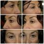 Photo of Tampa Bay Cosmetic Surgery Center