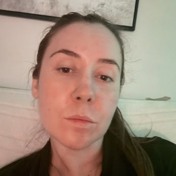 A Beauty Skin & Laser - No make up, no lotions, right after a face wash after a busy day at work - Laser Hair Removal Near Me - Plainfield, Illinois