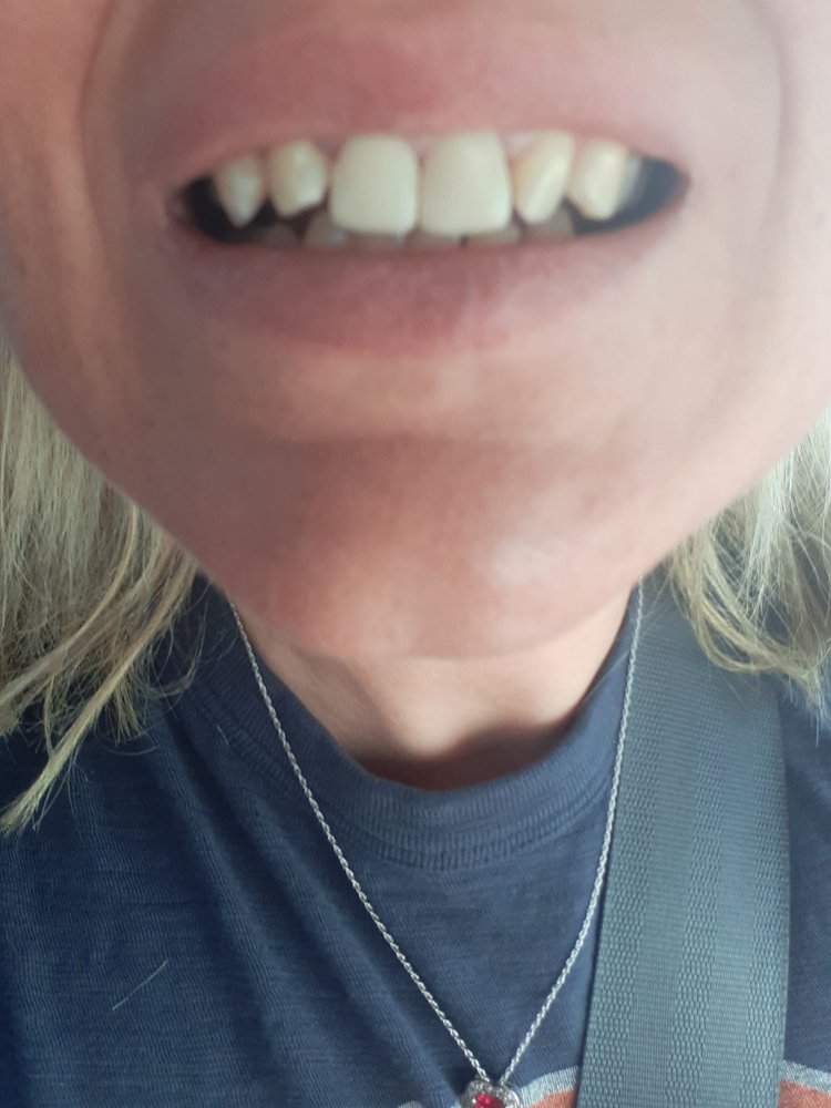 ALPHA DENTIST Updated May 2024 13 Reviews 2681 Wilcrest Dr