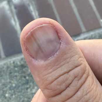 Lavender Nails & Spa - Nail not filed and cuticles were trimmed while dry. This was the aftermath - Nail Salons Near Me - Manteca, California