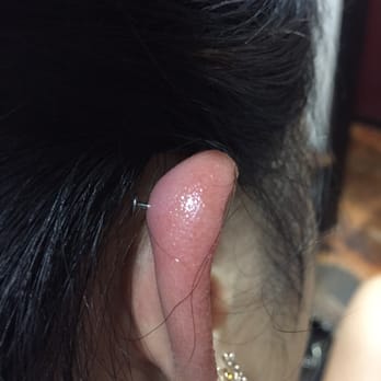 House of Ink - I know this is disgusting, but you don't want this to happen you. The earring in there is from after I replaced it. - Tattoo Near Me - Venice, California House of Ink - I know this is disgusting, but you don't want this to happen you. The earring in there is from after I replaced it. - Tattoo Near Me - Venice, California