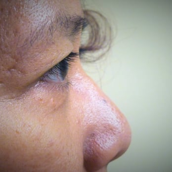 Lash Therapeutics - Before - side view eyes open - Eyelash Service Near Me - Toronto, Ontario Lash Therapeutics - Before - side view eyes open - Eyelash Service Near Me - Toronto, Ontario