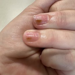 Bacteria was under my acrylic nails!