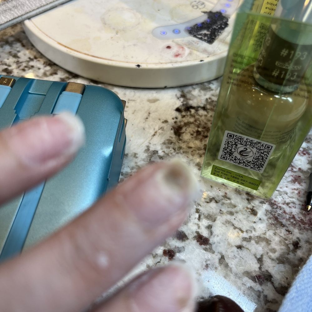 Serenity Nails & Spa - Fungus nail - Nail Salons Near Me - Gambrills, Maryland Serenity Nails & Spa - Fungus nail - Nail Salons Near Me - Gambrills, Maryland