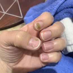 AFTER OSCARS AFTER OSCARS
