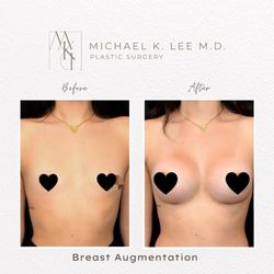Michael K Lee, MD - Patient