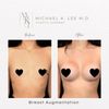 Michael K Lee, MD gift card