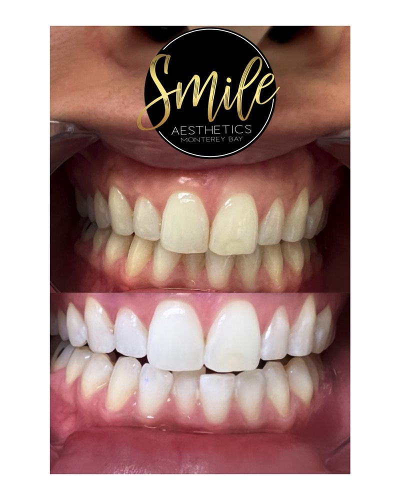SMILE AESTHETICS MONTEREY BAY 79 Photos 25 San Juan Grade Rd