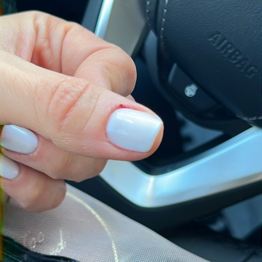Brilliant Nails Spa - Bleeding from over cutting cuticle - Skin Care Near Me - Great Neck, New York