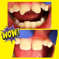 Kimmy - Don't fear if your child has a dental emergency - make sure to call Dr. Kimmy!