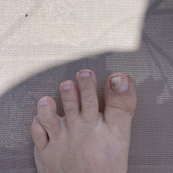 Oasis Nails Lounge - Nasty nail fungus - Nail Salons Near Me - Houston, Texas Oasis Nails Lounge - Nasty nail fungus - Nail Salons Near Me - Houston, Texas