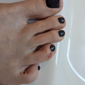 Nails & Spa - He scraped my ring toe with the grater several times. My big toenail is filed so short and at a weird angle. - Nail Salons Near Me - White Bear Lake, Minnesota Nails & Spa - He scraped my ring toe with the grater several times. My big toenail is filed so short and at a weird angle. - Nail Salons Near Me - White Bear Lake, Minnesota