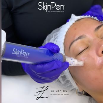HL Med Spa - MICRONEEDLING - Medical Spas Near Me - Newark, New Jersey HL Med Spa - MICRONEEDLING - Medical Spas Near Me - Newark, New Jersey