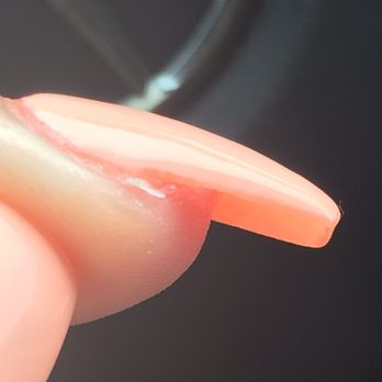 D Diamond Nails - I don't even know what is going on here, but it hurts - Nail Salons Near Me - Hallandale Beach, Florida