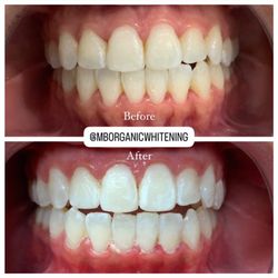 M&B Organic Whitening - Another satisfied client. We want you to come back so we take pride in our business and products.