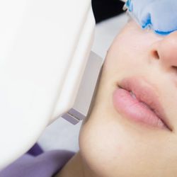 Vanish Skin and Laser