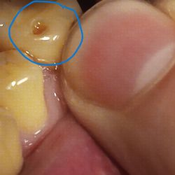 Apple Valley Dental & Braces