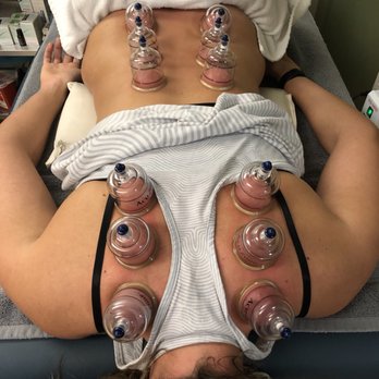 Balance Point Therapy - Acupuncture Near Me - Costa Mesa, California