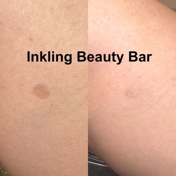 Inkling Beauty Bar - Permanent Makeup Near Me - San Francisco, California Inkling Beauty Bar - Permanent Makeup Near Me - San Francisco, California