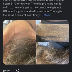 Poor hair quality