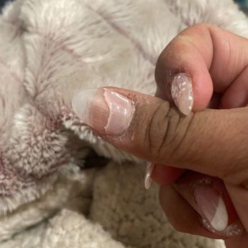 ReVive Nail Bar - Peeling after just 4 days - Nail Salons Near Me - Lynnwood, Washington