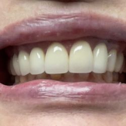 Sam Romano DMD, MAGD - New teeth