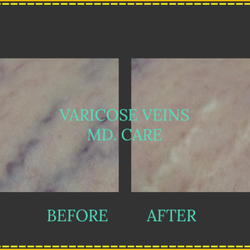 Pacific Surgical & Vein Institute