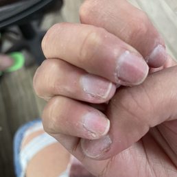 If you zoom in you can see the cuticles left behind If you zoom in you can see the cuticles left behind