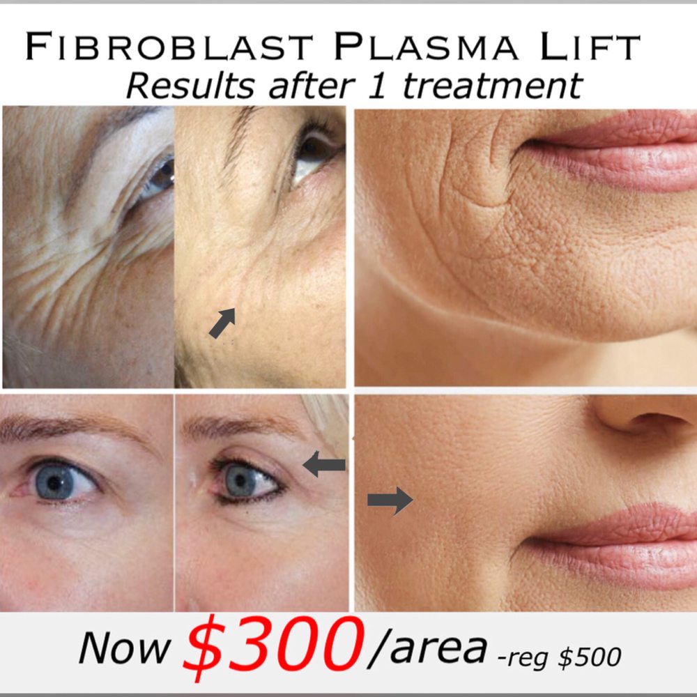 Permanent Makeup 4u 74 Photos - Permanent Makeup Toronto S Permanent Makeup 4u 74 Photos - Permanent Makeup Toronto S