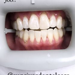 Sunriver Dental Care - After Photo