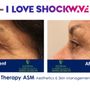Photo of Esteem Treatments