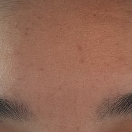 before before