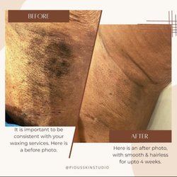 Pious Skin Studio