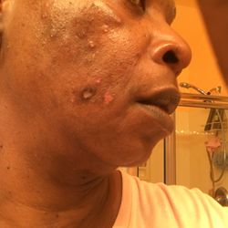 Unique Dermatology