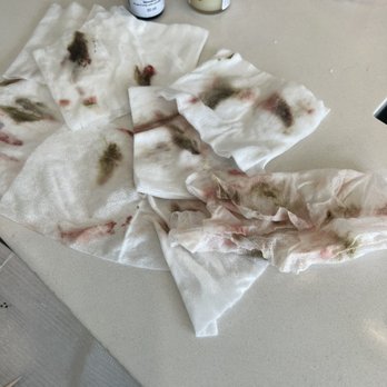 Mehrin Glam - Ink removal session 4 - Permanent Makeup Near Me - Sherman Oaks, California Mehrin Glam - Ink removal session 4 - Permanent Makeup Near Me - Sherman Oaks, California