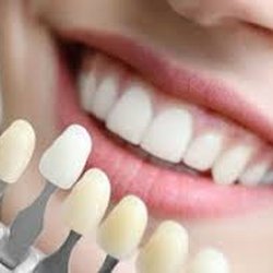 Susan Ho, DDS - Kensington Natural Smiles - We offer Zoom Whitening and Take Home Bleaching Kits