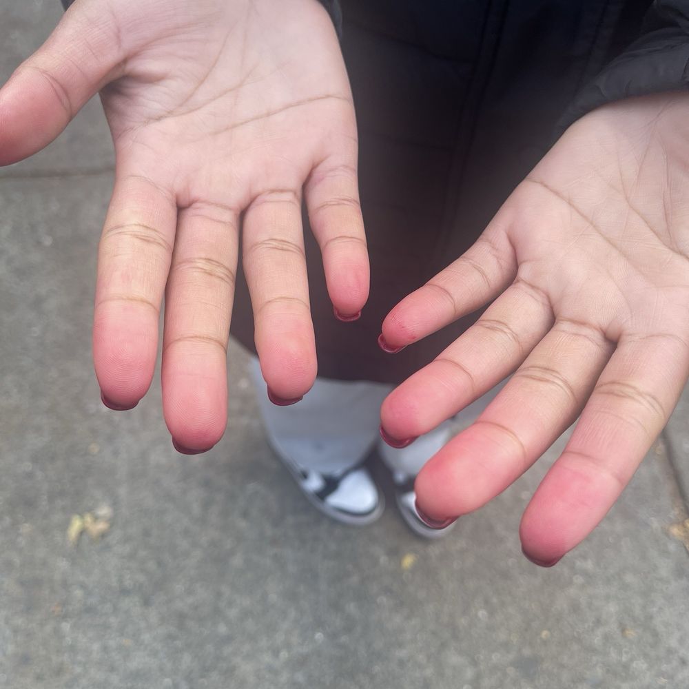 Dorée Nails & Spa - Stained fingertips - Skin Care Near Me - New York, New York