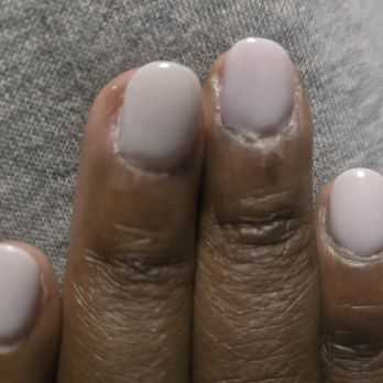 Wonder Nails - 2 days later after they fixed it. I requested for Alex to clean it up but she dismissed me b/c she had a client. - Nail Salons Near Me - Nanuet, New York Wonder Nails - 2 days later after they fixed it. I requested for Alex to clean it up but she dismissed me b/c she had a client. - Nail Salons Near Me - Nanuet, New York
