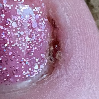 Lexor Spa & Nails - Injury while receiving a pedicure - Nail Salons Near Me - Lansing, Michigan Lexor Spa & Nails - Injury while receiving a pedicure - Nail Salons Near Me - Lansing, Michigan