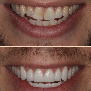 Dr. Jorg-Peter Rabanus - Cosmetic Dentists Near Me - San Francisco, California