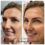 Photo of Permanent Makeup by Sharaine