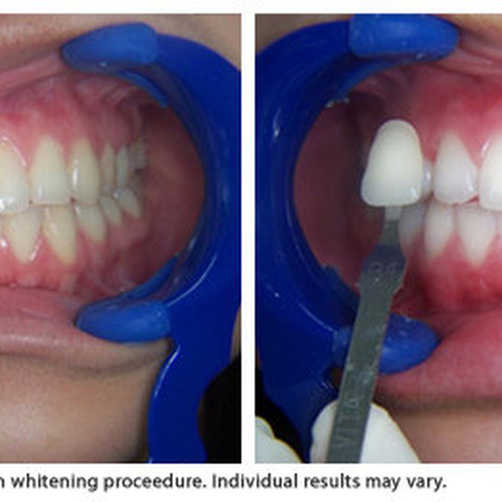 ModernSmile - Cosmetic Dentists Near Me - Syosset, New York ModernSmile - Cosmetic Dentists Near Me - Syosset, New York
